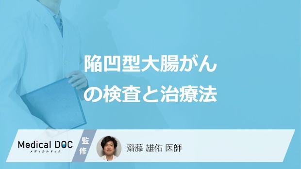 「陥凹型大腸がん」の”3つの治療法”はご存じですか？検査法も医師が解説！