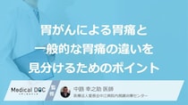 胃薬を飲めば安心という落とし穴？「胃がん」の胃痛を見逃しやすい“原因”【医師監修】
