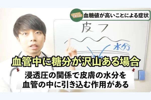 血糖値の急上昇で「皮膚が乾燥」？ 手以外に表れる3つの初期症状