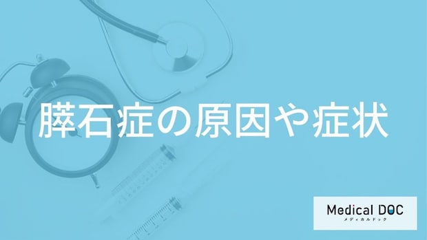 「膵石症」の症状はご存じですか？原因やなりやすい人の特徴も医師が解説！