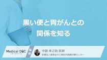 「胃がん」のサインが便に出る？見逃し厳禁な“あの黒い便”の正体を医師が解説