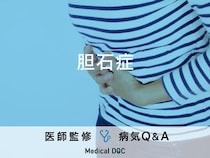 「胆石症」の症状・原因・発症しやすい人の特徴はご存知ですか？医師が監修！