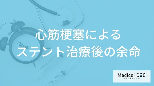 「心筋梗塞ステント治療」後の”余命”を延ばす方法はご存じですか？治療の特徴も医師が解説