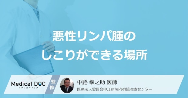 「悪性リンパ腫のしこりができる場所」はご存知ですか？【医師監修】
