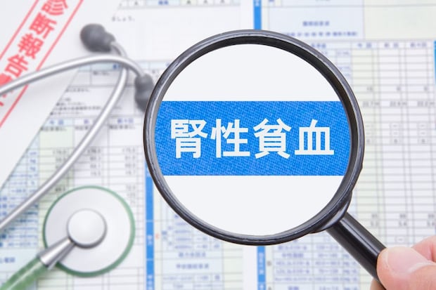 腎性貧血と腎臓の関係