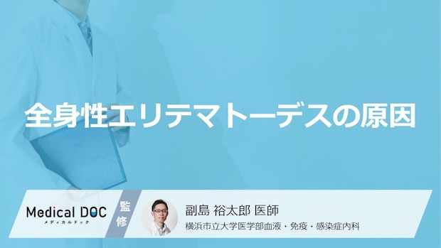 「全身性エリテマトーデスの原因」はご存知ですか？発症しやすい年齢や性別も解説！