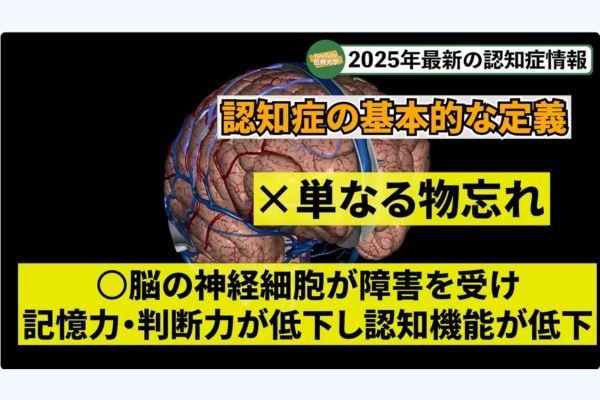 認知症は単なる物忘れではない？ 発症のメカニズムと意外なリスク