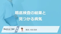 「眼底検査」で異常が見つかった時の費用と検査は？見つかる病気も医師が解説！