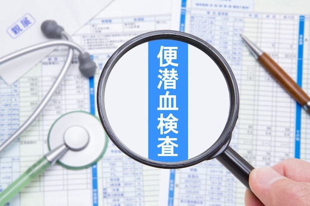 医師が解説 便潜血検査の基本