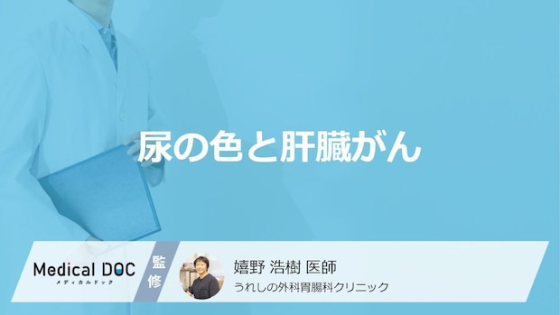 「肝臓がん」を疑う「尿の色」はご存知ですか？受診の目安となる尿の色も医師が解説！
