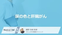 「肝臓がん」を疑う「尿の色」はご存知ですか？受診の目安となる尿の色も医師が解説！