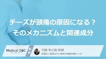 「チーズ」と“あの食品”が片頭痛を招く？知っておきたい原因と症状【医師監修】
