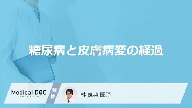 「糖尿病」による「皮膚症状」を放置するとどうなる？【医師監修】
