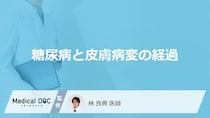 「糖尿病」による「皮膚症状」を放置するとどうなる？【医師監修】