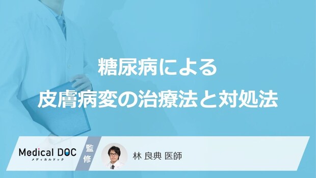 「糖尿病」による「皮膚症状」の治療法はご存知ですか?【医師監修】