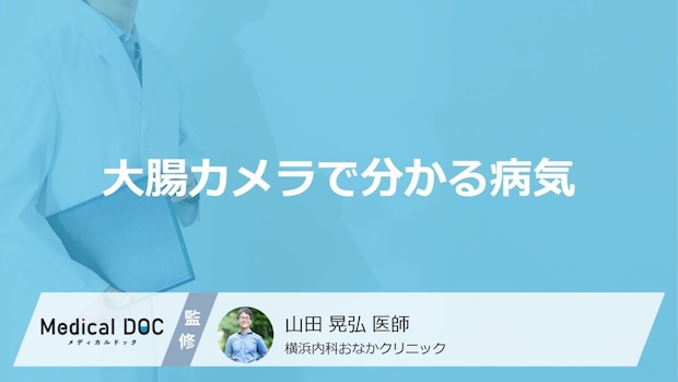 大腸がんを見つける「大腸カメラ」では何をするかご存じですか? 検査の流れを医師が解説!