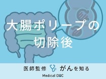 「大腸ポリープ切除後」の食事メニューや控えた方がよい食事はご存知ですか？