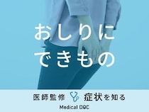 「おしりにできもの」ができる原因をご存知ですか？医師が徹底解説！