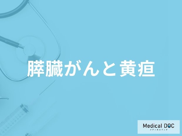 「膵臓がん」で”黄疸”が出た場合の平均余命はご存じですか?初期症状も医師が解説!