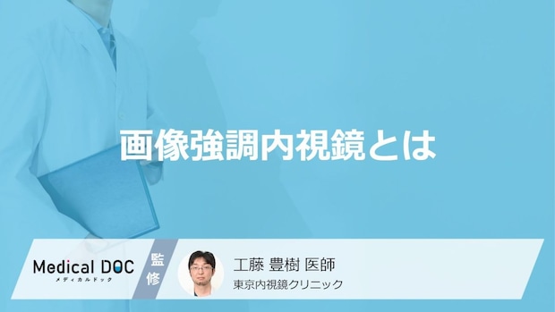 早期がんを発見する新技術! 画像強調内視鏡の革命的な進化と効果について医師が解説