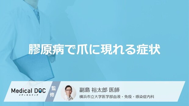 「膠原病」を発症すると「爪」にどんな症状が現れるかご存知ですか?【医師監修】