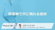 「膠原病」を発症すると「爪」にどんな症状が現れるかご存知ですか？【医師監修】