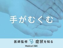 「手がむくむ」原因はご存知ですか？医師が監修！