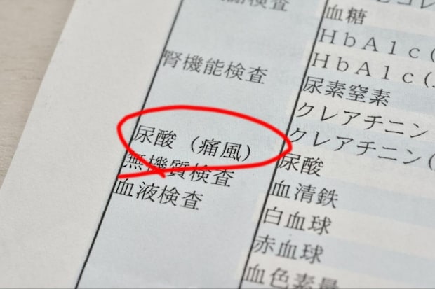 痛風予防の基本的な考え方
