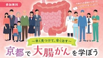 “ステージ1で生存率92%、4で約18%”…大腸がん「早く見つけて早く治す」意義、市民講座で京大医師らが解説