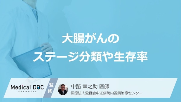 「大腸がん」の”ステージ別の生存率”はご存じですか？ステージを決める指標も医師が解説！
