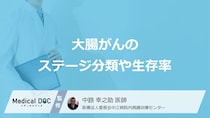 「大腸がん」の”ステージ別の生存率”はご存じですか？ステージを決める指標も医師が解説！