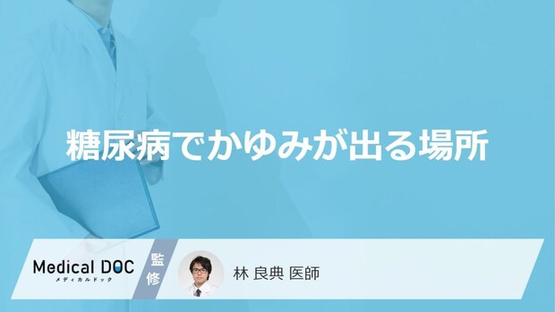 「糖尿病」を発症するとどこに「かゆみ」が出やすいかご存知ですか？【医師監修】