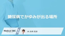 「糖尿病」を発症するとどこに「かゆみ」が出やすいかご存知ですか？【医師監修】