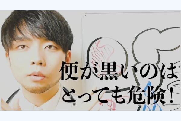 大腸がんのリスクを高める「5つの要因」