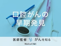 「口腔がんの早期発見」するには？セルフチェック法や検査方法も解説！