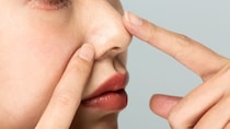「鼻整形」のリスクをご存じですか？ 後悔しないための知識を美容外科医が解説
