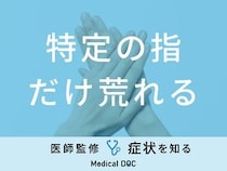「特定の指だけ荒れる」原因はご存知ですか？医師が徹底解説！