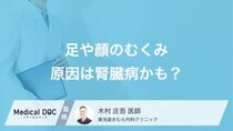全身のむくみは「腎臓病」のサイン? 注意したいむくみの特徴を医師が解説!
