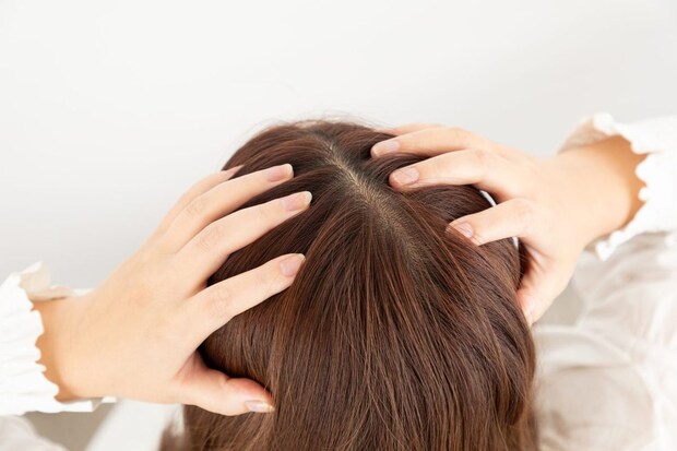 男性の薄毛とどう違う？ 見た目と原因の違い