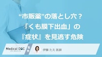 “市販薬”の落とし穴？「くも膜下出血」の『症状』を見逃す危険【医師】