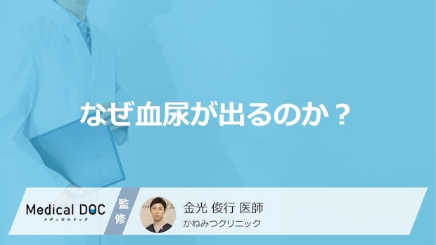 血尿には2種類ある?痛みの有無で見分ける重大な病気のサイン【医師解説】
