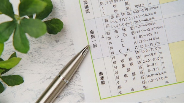 アジソン病の症状に気付いたときの受診の目安と検査