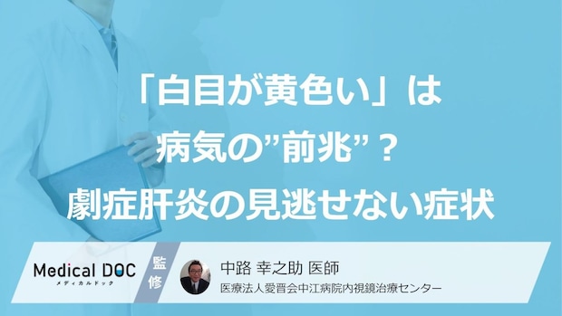 「白目が黄色い」は病気の”前兆”？ 劇症肝炎の『見逃せない症状』【医師監修】