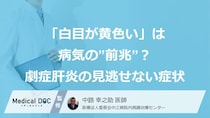 「白目が黄色い」は病気の”前兆”？ 劇症肝炎の『見逃せない症状』【医師監修】