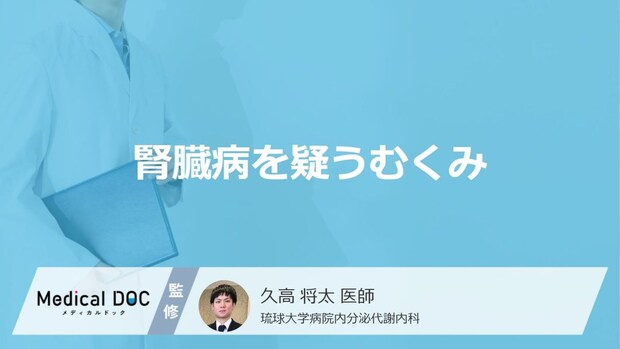 腎臓病の疑いがあるのは「朝になると顔がむくむ」「夕方になると足がむくむ」どっち？
