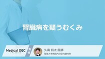 腎臓病の疑いがあるのは「朝になると顔がむくむ」「夕方になると足がむくむ」どっち？