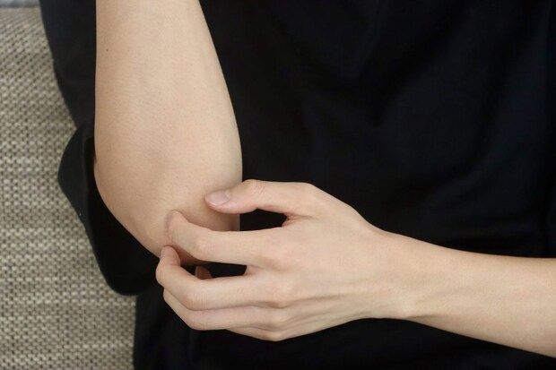 膠原病の初期にみられる代表的な初期症状