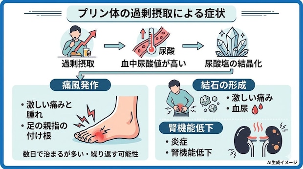 プリン体を過剰摂取すると現れる症状