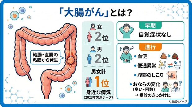 「大腸がん」とは?