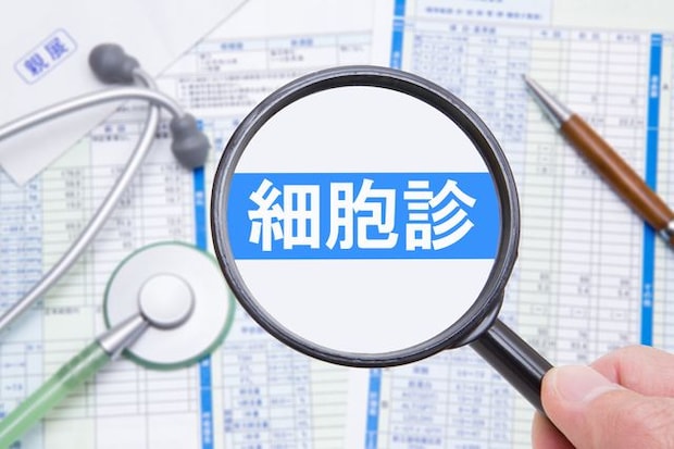 検診では問題なかったが、しこりが大きくなり病院を受診した